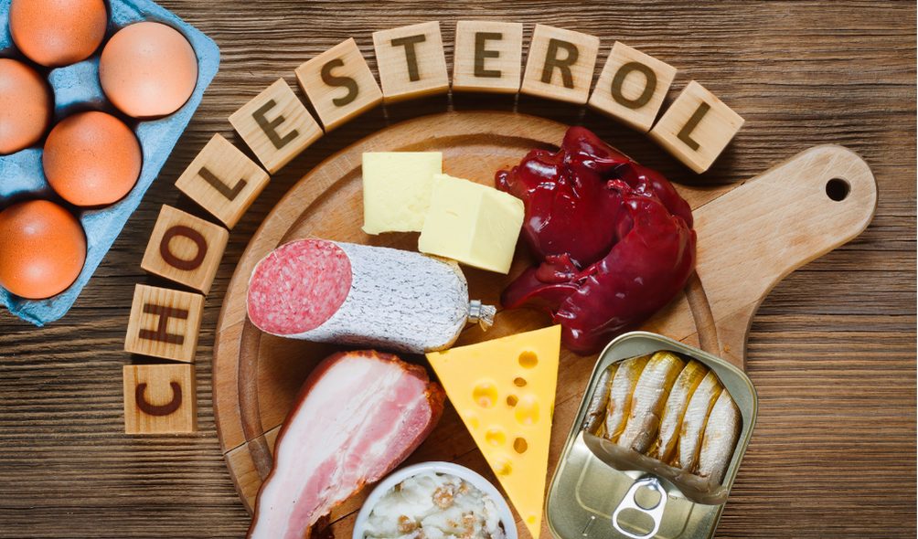 3 Symptoms That Indicates Your Cholesterol Levels are High